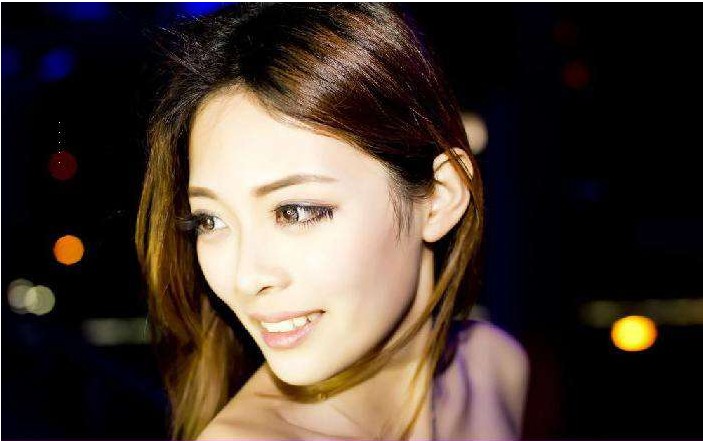 腹腔镜手术后应该注意什么
